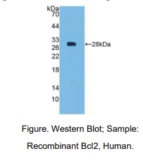 https://msimg.bioon.com/bionline/goods-no-pic.png