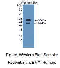 人BMX非受体酪氨酸激酶(BMX)多克隆抗体