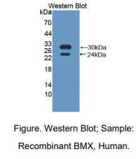 https://msimg.bioon.com/bionline/goods-no-pic.png