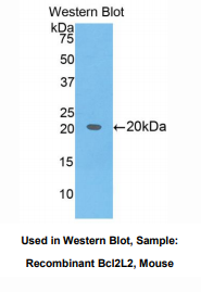 https://msimg.bioon.com/bionline/goods-no-pic.png