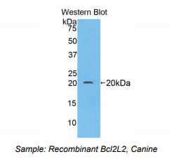 https://msimg.bioon.com/bionline/goods-no-pic.png