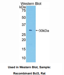 https://msimg.bioon.com/bionline/goods-no-pic.png