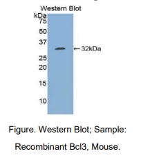 https://msimg.bioon.com/bionline/goods-no-pic.png