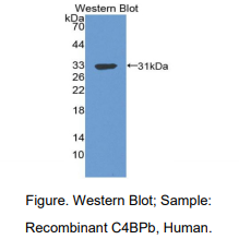 人C4结合蛋白β(C4BPb)多克隆抗体
