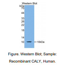 人Calcyon神经元特异性囊泡蛋白(CALY)多克隆抗体