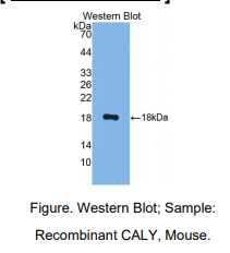 小鼠Calcyon神经元特异性囊泡蛋白(CALY)多克隆抗体