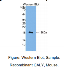 https://msimg.bioon.com/bionline/goods-no-pic.png