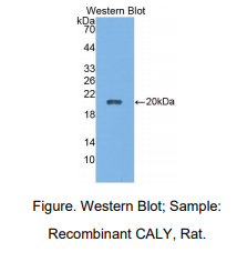大鼠Calcyon神经元特异性囊泡蛋白(CALY)多克隆抗体