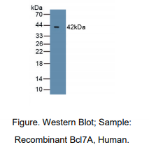 人B-细胞淋巴瘤因子7A(Bcl7A)多克隆抗体