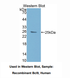人B-细胞淋巴瘤因子9(Bcl9)多克隆抗体