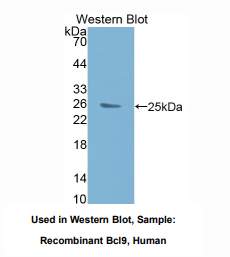 https://msimg.bioon.com/bionline/goods-no-pic.png