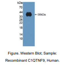 https://msimg.bioon.com/bionline/goods-no-pic.png