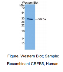人cAMP应答元件结合蛋白5(CREB5)多克隆抗体