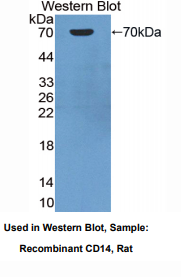 https://msimg.bioon.com/bionline/goods-no-pic.png