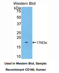 人CD160分子(CD160)多克隆抗体