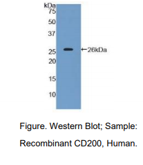 人CD200分子(CD200)多克隆抗体