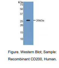 https://msimg.bioon.com/bionline/goods-no-pic.png