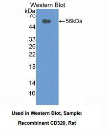 https://msimg.bioon.com/bionline/goods-no-pic.png