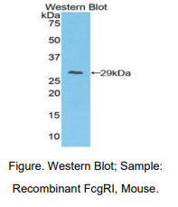 https://msimg.bioon.com/bionline/goods-no-pic.png