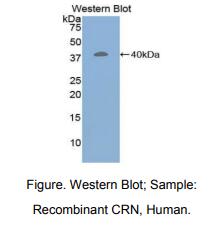 小鼠Corin蛋白(CRN)多克隆抗体