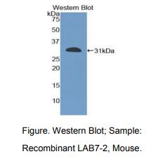 https://msimg.bioon.com/bionline/goods-no-pic.png