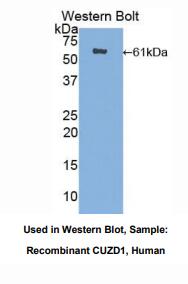 https://msimg.bioon.com/bionline/goods-no-pic.png