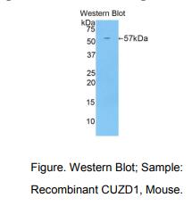 https://msimg.bioon.com/bionline/goods-no-pic.png