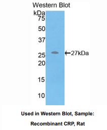 https://msimg.bioon.com/bionline/goods-no-pic.png