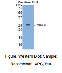 大鼠C组着色性干皮病偶联因子(XPC)多克隆抗体