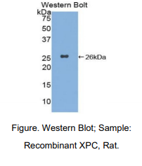 https://msimg.bioon.com/bionline/goods-no-pic.png