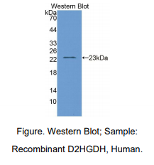 人D2-羟基戊二酸二乙酯脱氢酶(D2HGDH)多克隆抗体