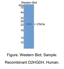 https://msimg.bioon.com/bionline/goods-no-pic.png