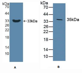 人Dickkopf相关蛋白1(DKK1)多克隆抗体