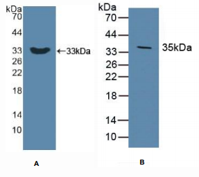 https://msimg.bioon.com/bionline/goods-no-pic.png