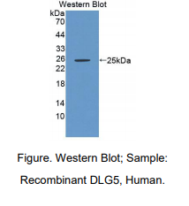 人Discs大同源物5(DLG5)多克隆抗体