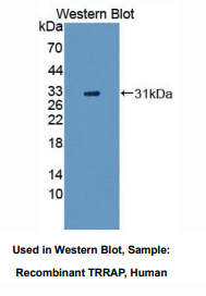 人转化/转录域关联蛋白(TRRAP)多克隆抗体