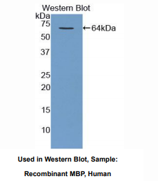 https://msimg.bioon.com/bionline/goods-no-pic.png