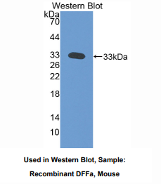 https://msimg.bioon.com/bionline/goods-no-pic.png