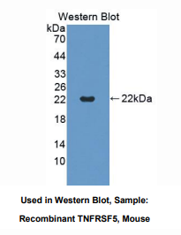 https://msimg.bioon.com/bionline/goods-no-pic.png