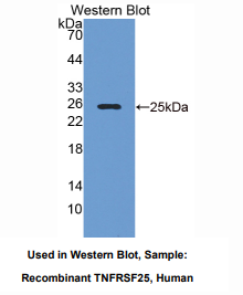 https://msimg.bioon.com/bionline/goods-no-pic.png