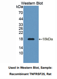 https://msimg.bioon.com/bionline/goods-no-pic.png