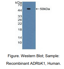 https://msimg.bioon.com/bionline/goods-no-pic.png