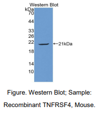 https://msimg.bioon.com/bionline/goods-no-pic.png