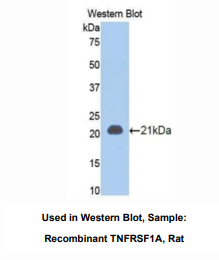 https://msimg.bioon.com/bionline/goods-no-pic.png