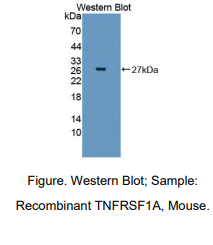 小鼠肿瘤坏死因子受体超家族成员1A(TNFR1)多克隆抗体