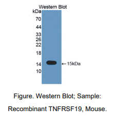 https://msimg.bioon.com/bionline/goods-no-pic.png