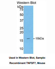 https://msimg.bioon.com/bionline/goods-no-pic.png