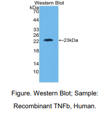 人肿瘤坏死因子β(TNFb)多克隆抗体