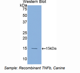 https://msimg.bioon.com/bionline/goods-no-pic.png