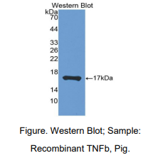 https://msimg.bioon.com/bionline/goods-no-pic.png